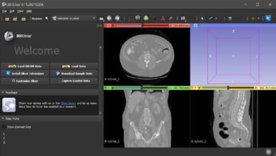 Photo of 6 Best Free Software For Viewing DICOM Files