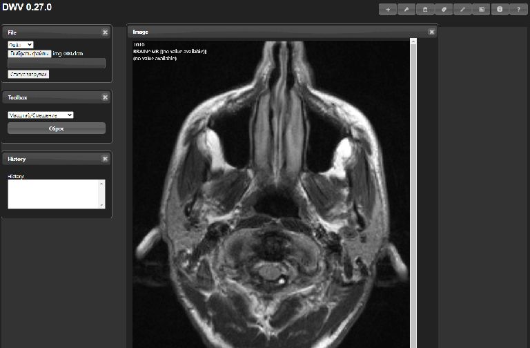 DICOM Web Viewer